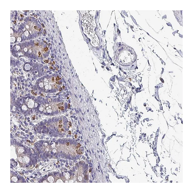 Atlas Antibodies Anti-NCF1 Antibody