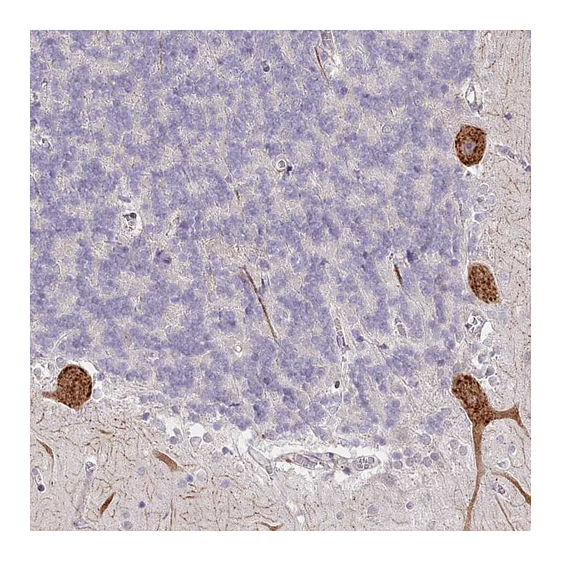 Atlas Antibodies Anti-NCKAP5 Antibody