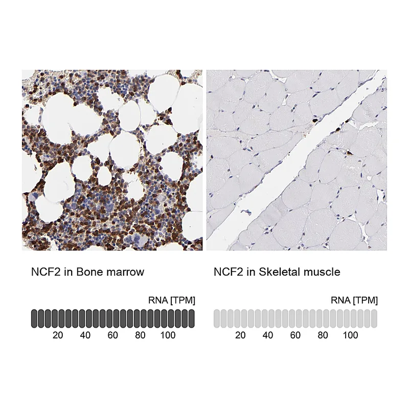 Atlas Antibodies Anti-NCF2 Antibody