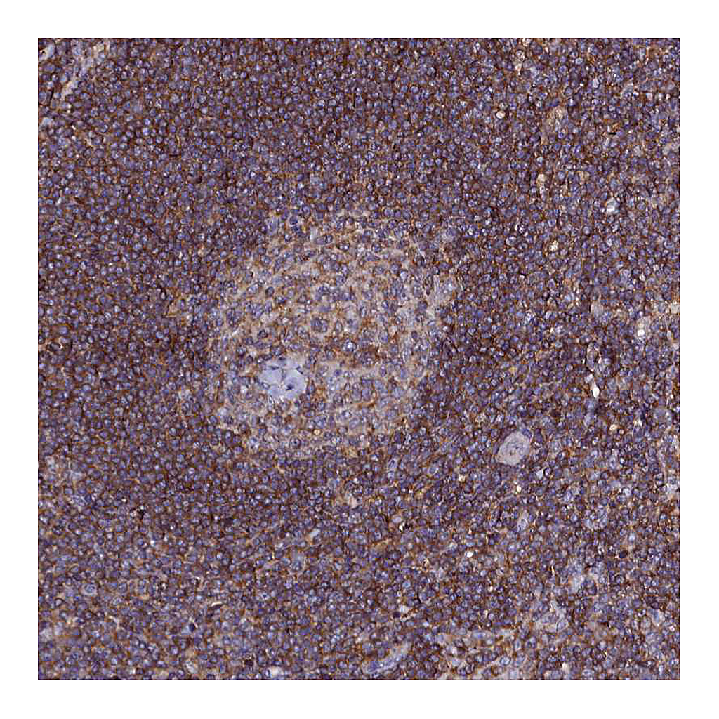 Atlas Antibodies Anti-NCKAP1L Antibody