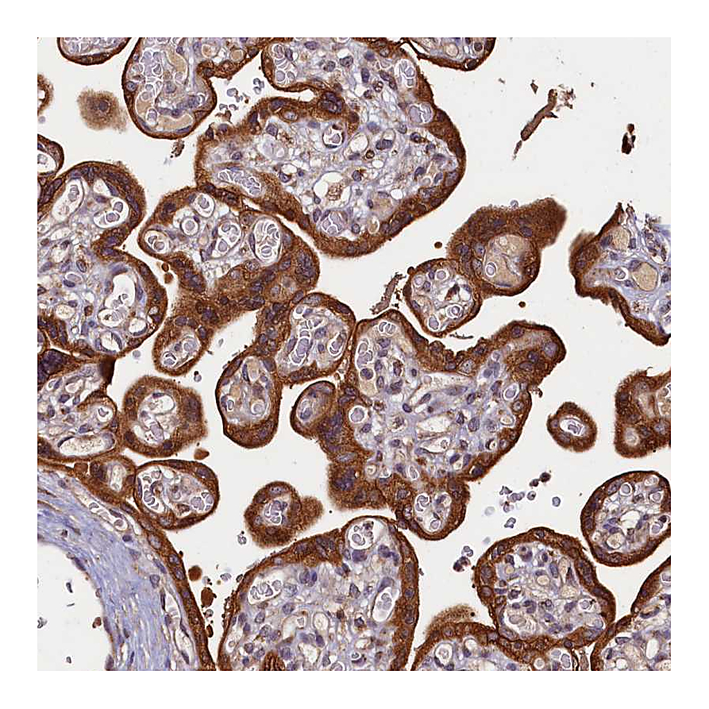 Atlas Antibodies Anti-NCKAP5L Antibody