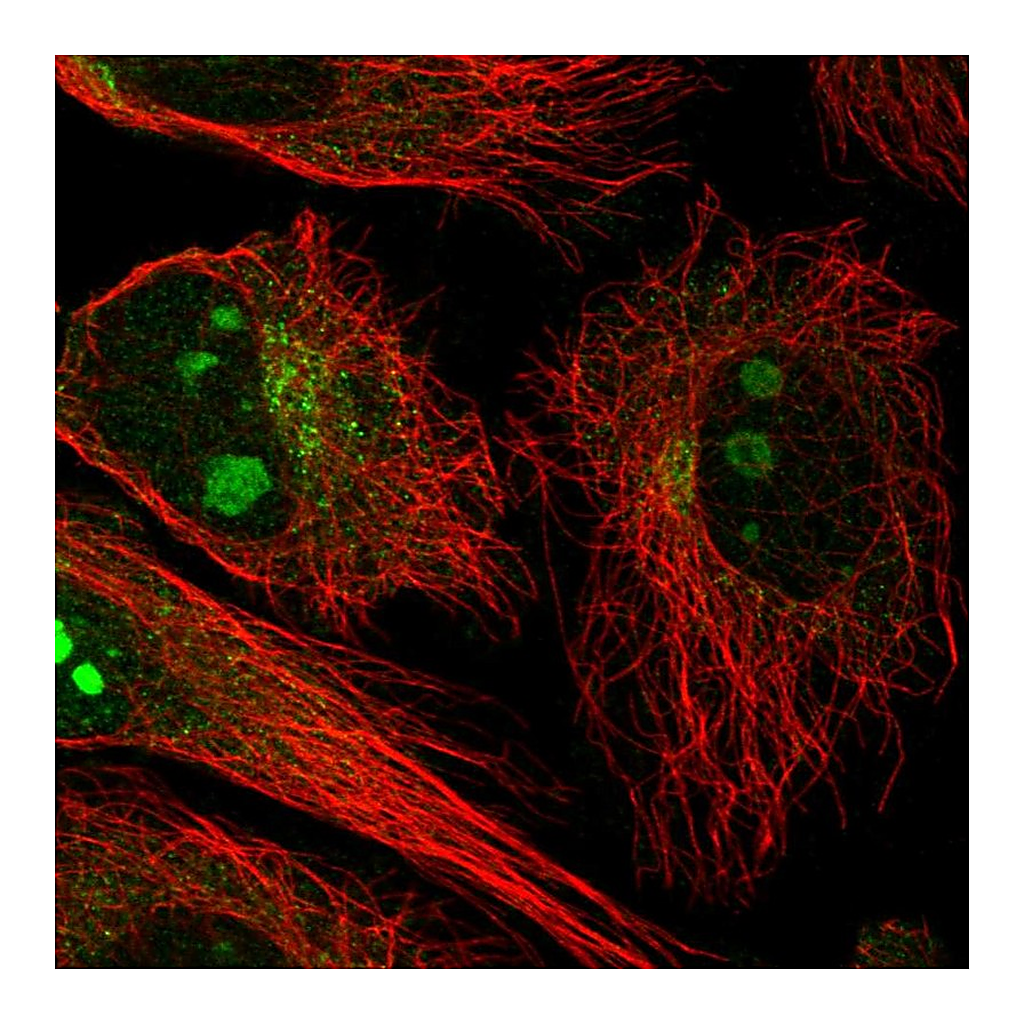 Atlas Antibodies Anti-NCKAP5 Antibody