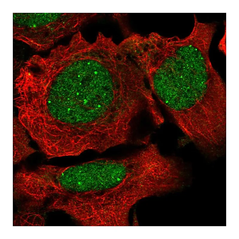 Atlas Antibodies Anti-NCOA2 Antibody