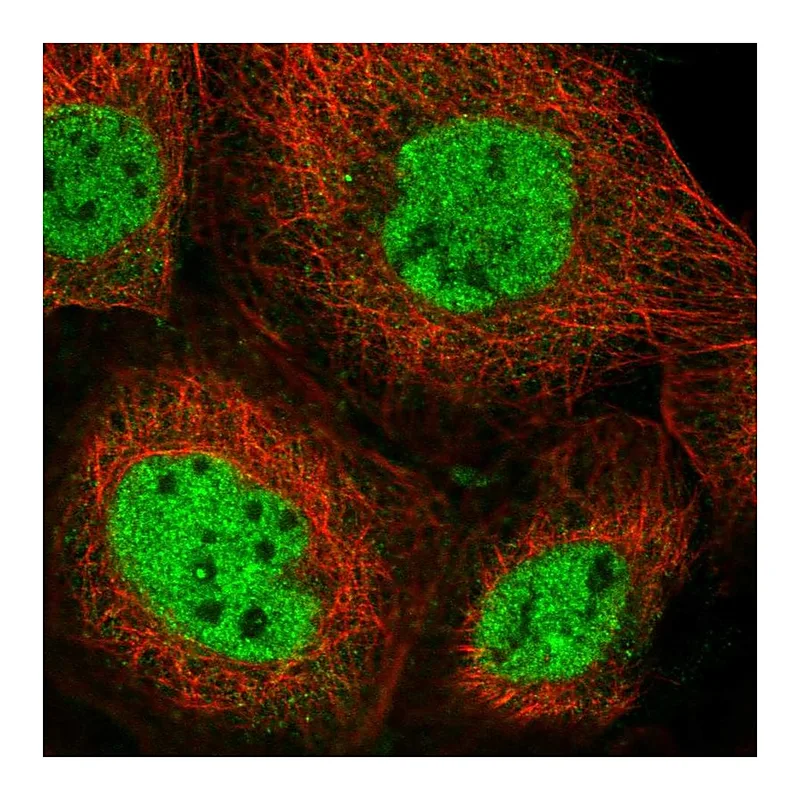 Atlas Antibodies Anti-NCOA6 Antibody