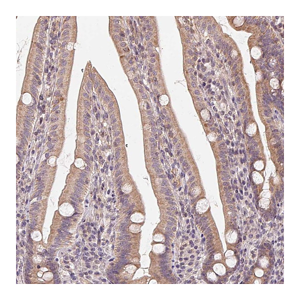 Atlas Antibodies Anti-NCOA4 Antibody