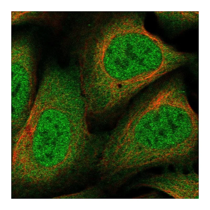 Atlas Antibodies Anti-NCOR1 Antibody