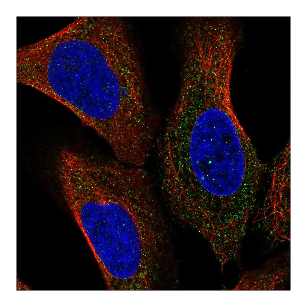 Atlas Antibodies Anti-NCSTN Antibody