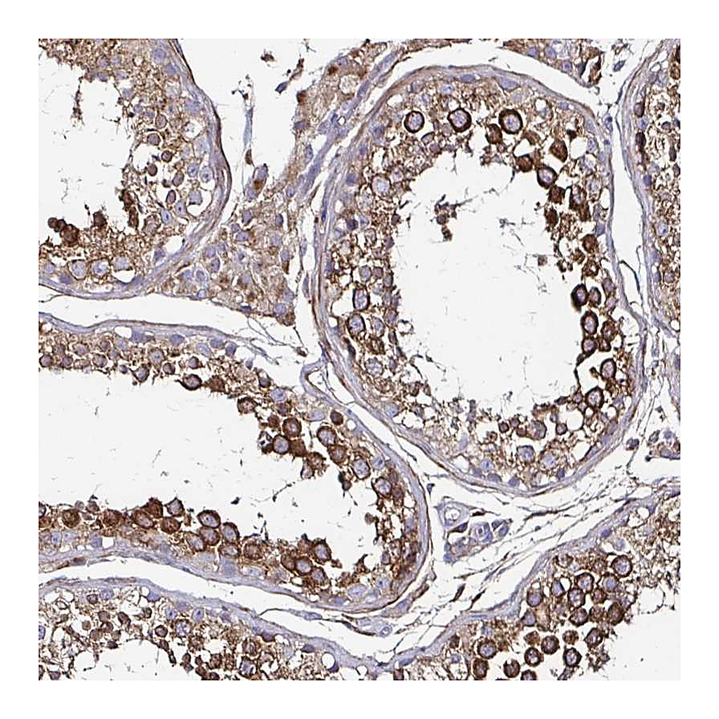 Atlas Antibodies Anti-NCSTN Antibody