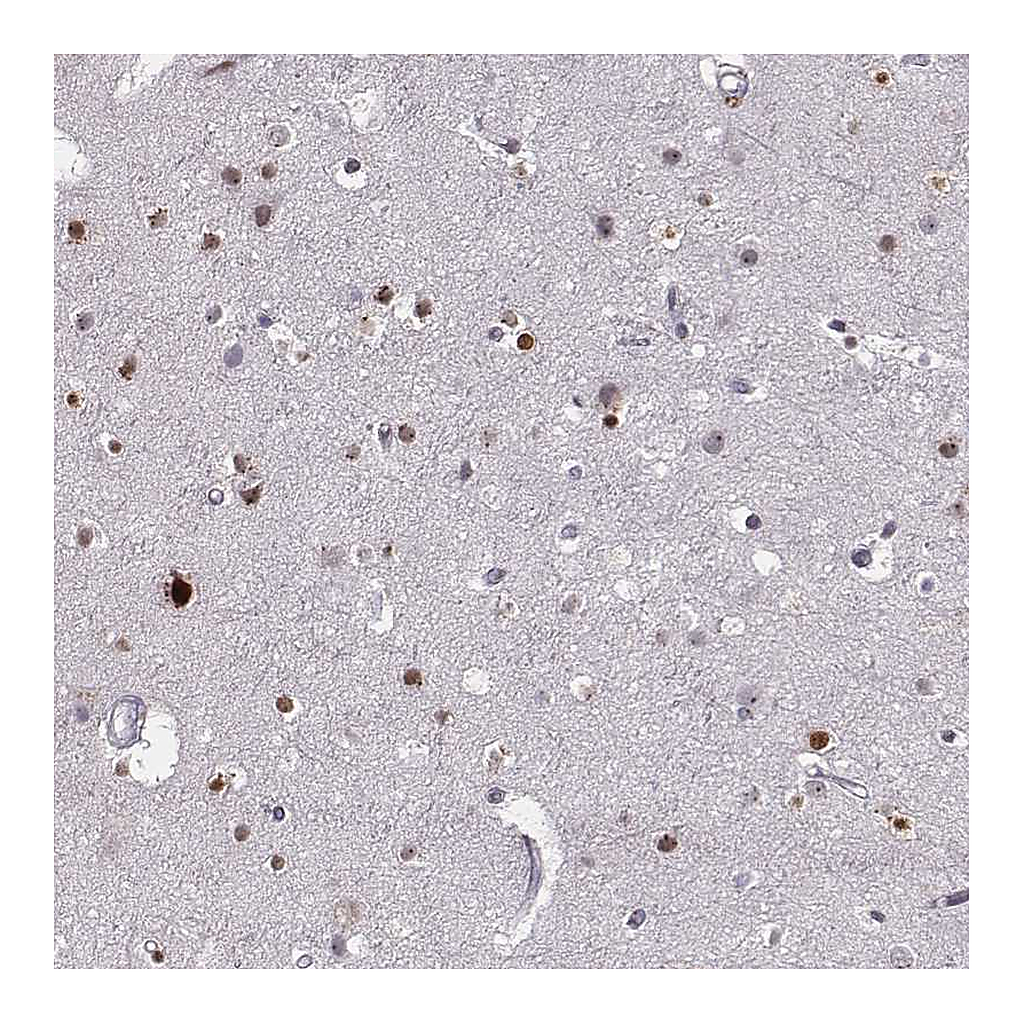 Atlas Antibodies Anti-NDC1 Antibody