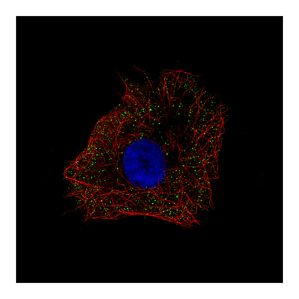 Atlas Antibodies Anti-NDP Antibody