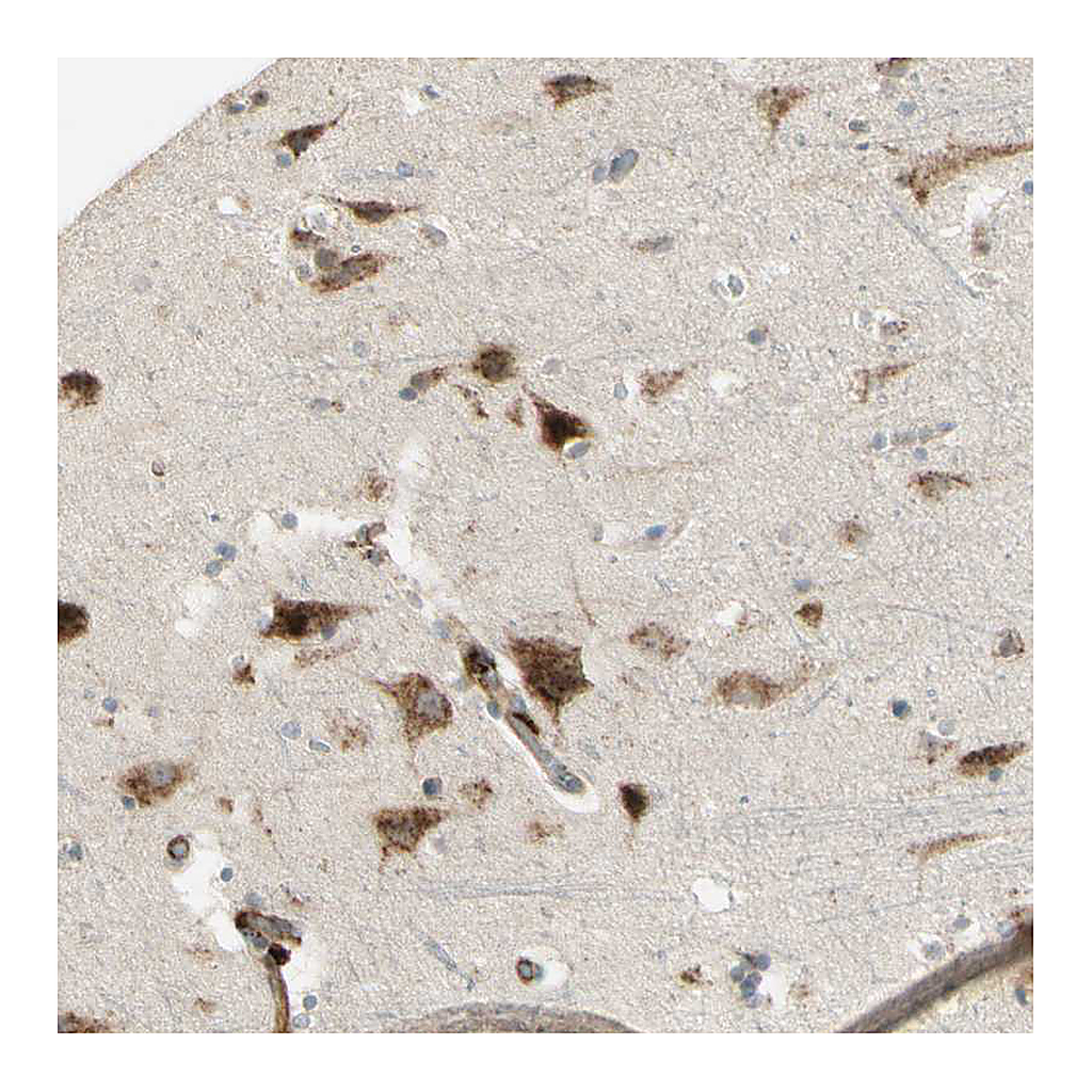 Atlas Antibodies Anti-NDFIP1 Antibody