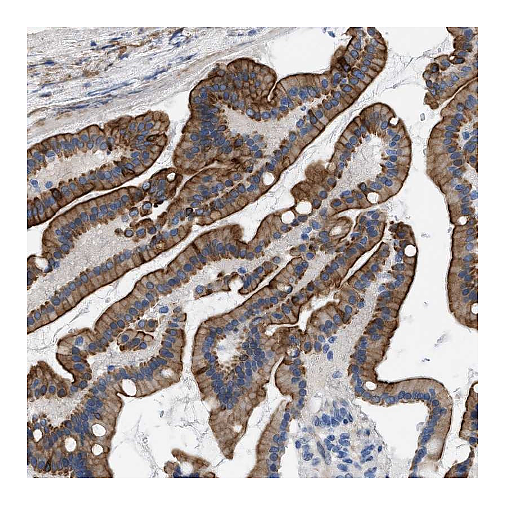 Atlas Antibodies Anti-NDEL1 Antibody
