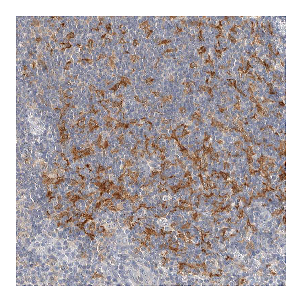 Atlas Antibodies Anti-NDE1 Antibody