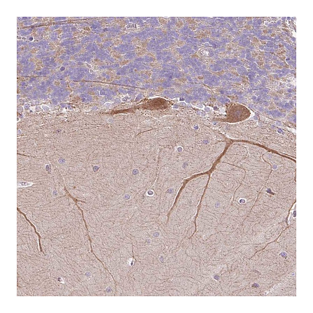 Atlas Antibodies Anti-NDST3 Antibody