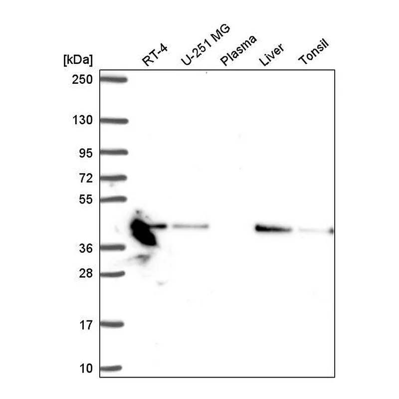 Atlas Antibodies Anti-NDUFA10 Antibody