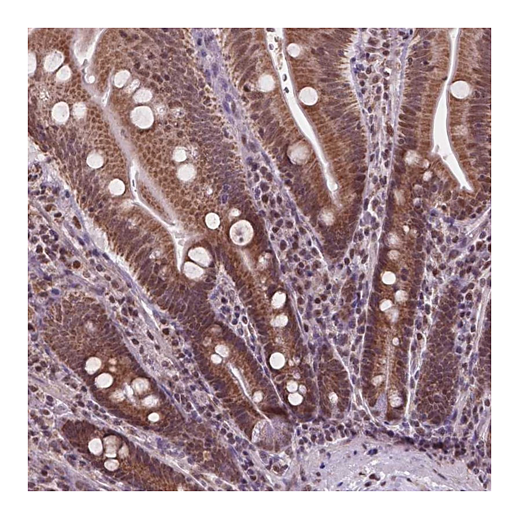 Atlas Antibodies Anti-NDUFA10 Antibody