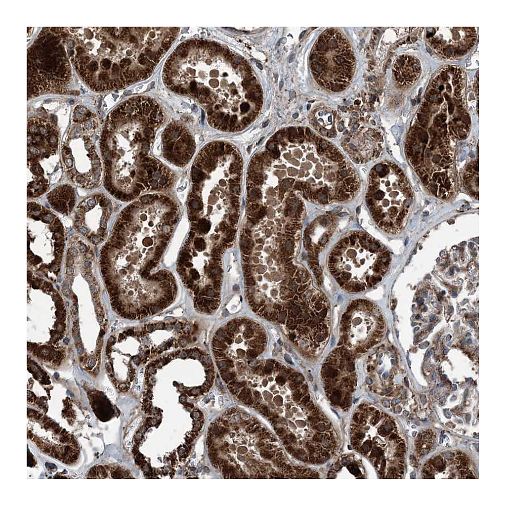 Atlas Antibodies Anti-NDUFA2 Antibody
