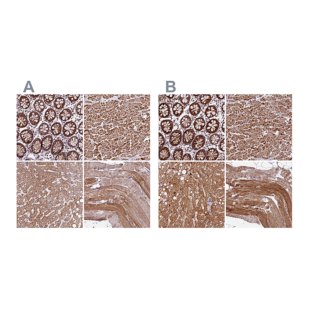 Atlas Antibodies Anti-NDUFA8 Antibody