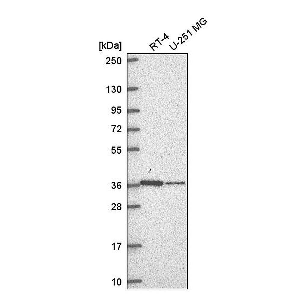 Atlas Antibodies Anti-NDUFA9 Antibody