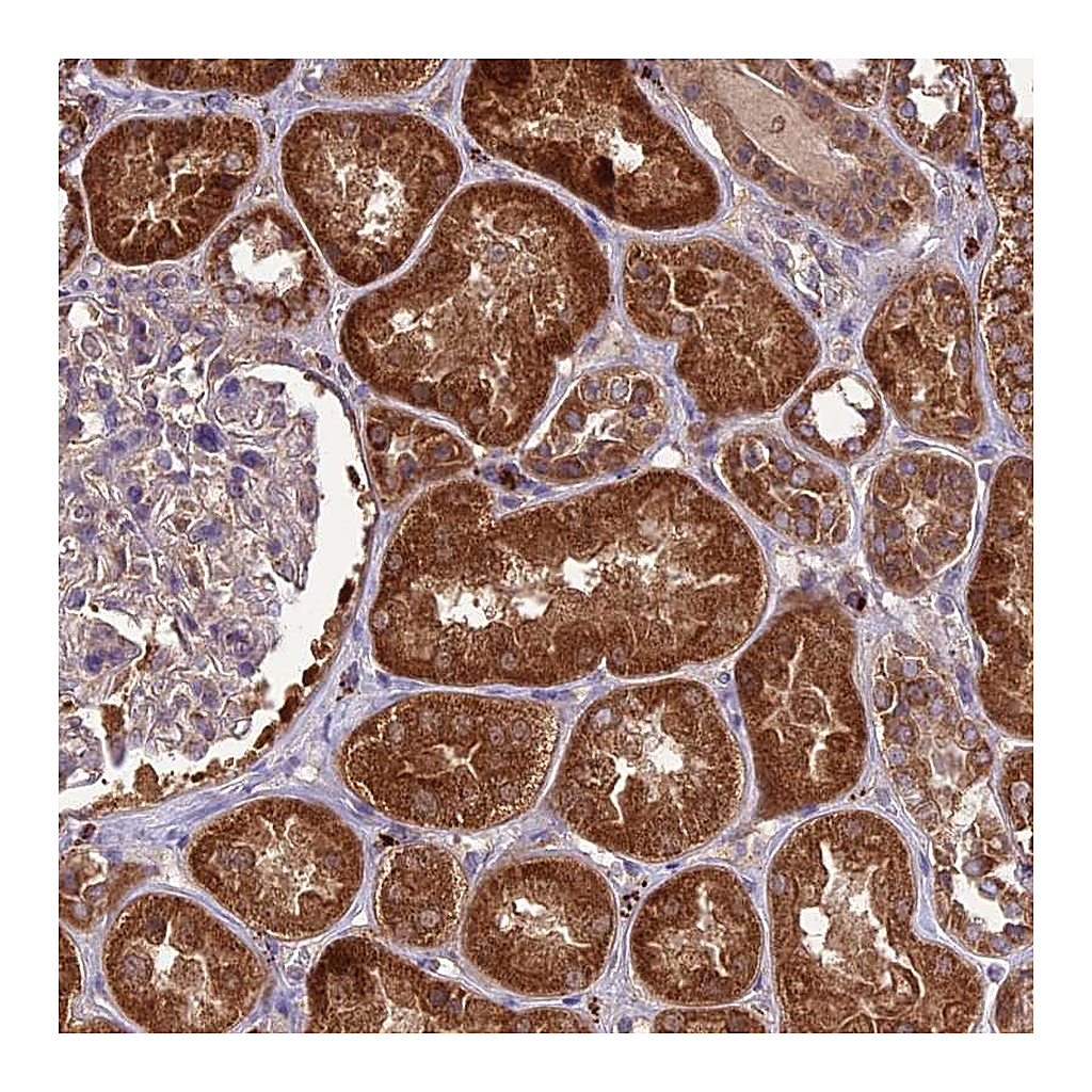 Atlas Antibodies Anti-NDUFAF1 Antibody