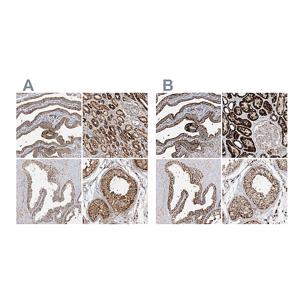 Atlas Antibodies Anti-NDUFAF3 Antibody