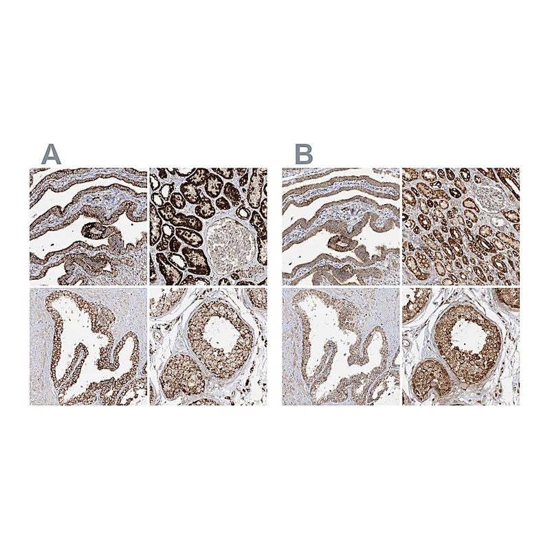 Atlas Antibodies Anti-NDUFAF3 Antibody