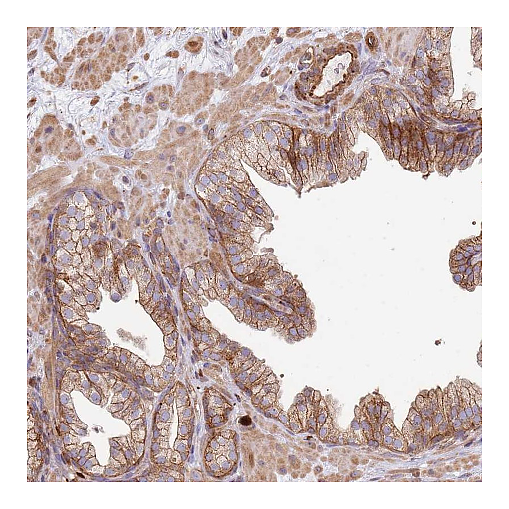Atlas Antibodies Anti-NDUFAF4 Antibody