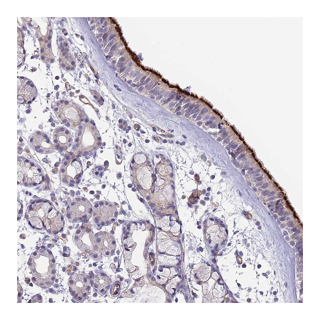 Atlas Antibodies Anti-NDUFAF5 Antibody