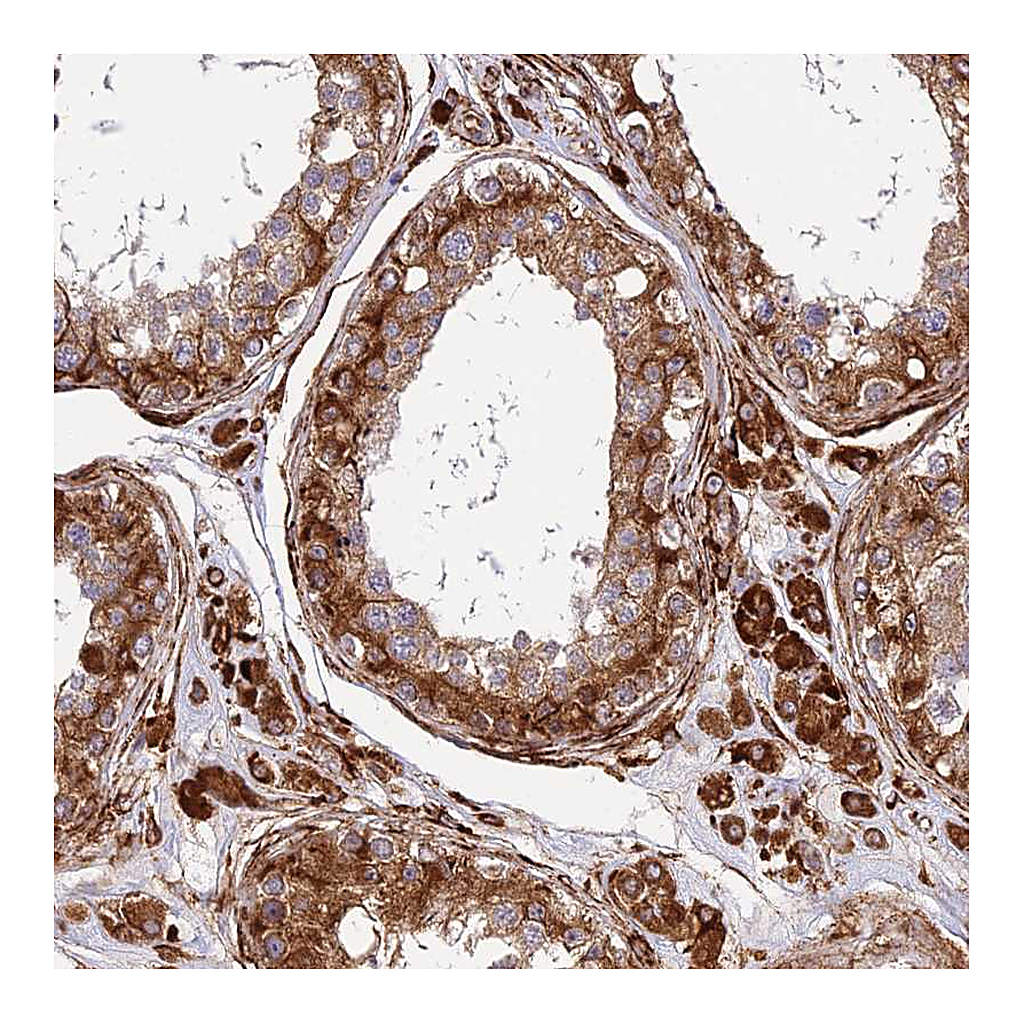 Atlas Antibodies Anti-NDUFAF7 Antibody