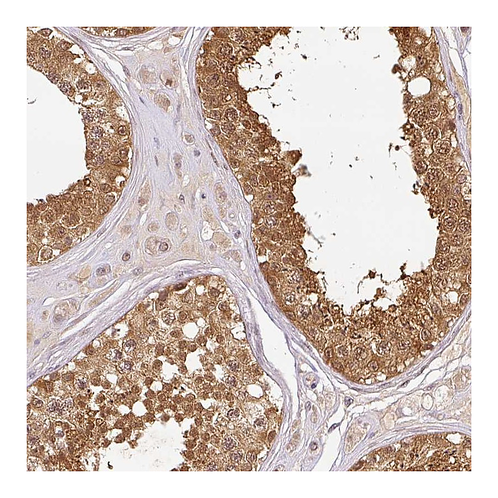Atlas Antibodies Anti-NDUFB2 Antibody
