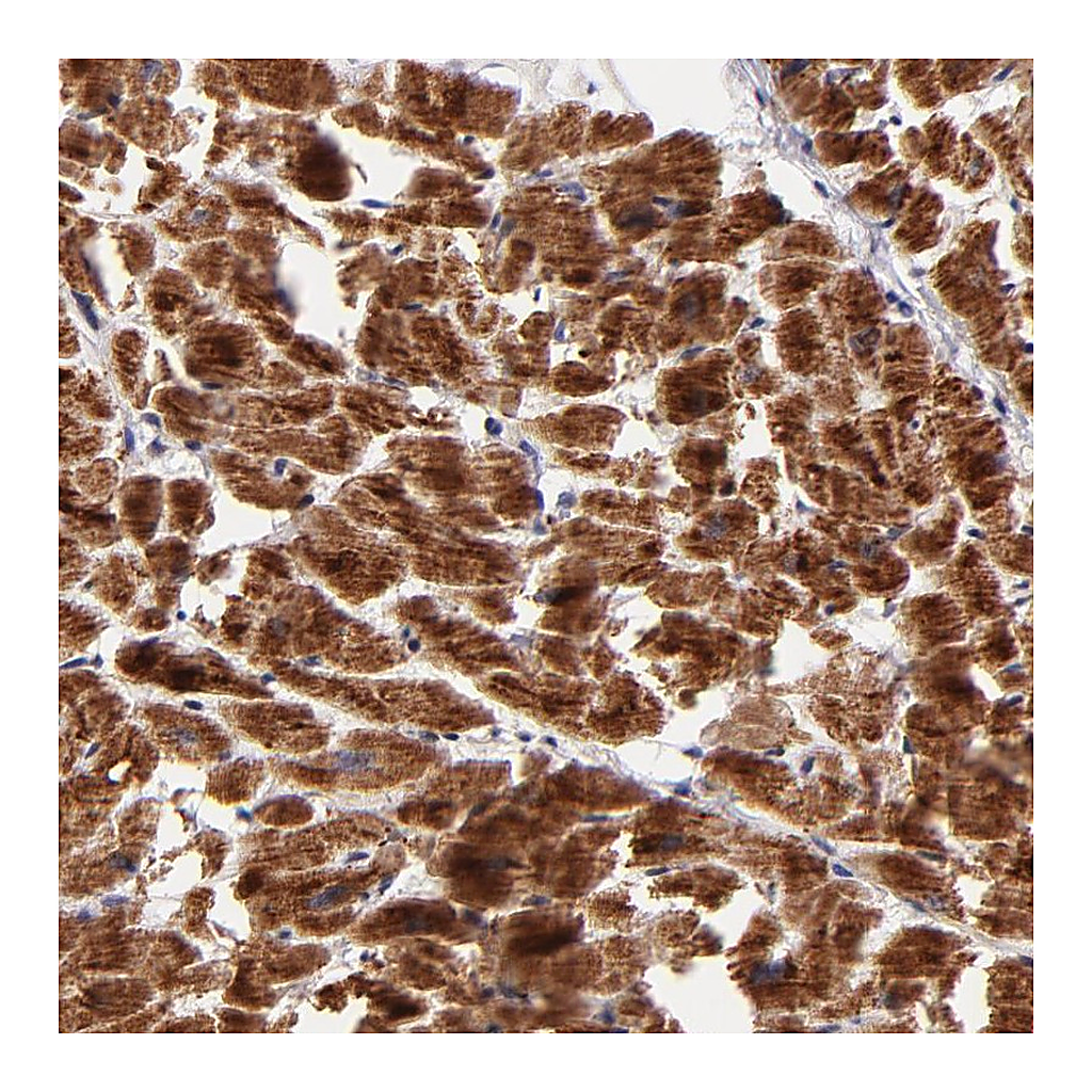 Atlas Antibodies Anti-NDUFB7 Antibody