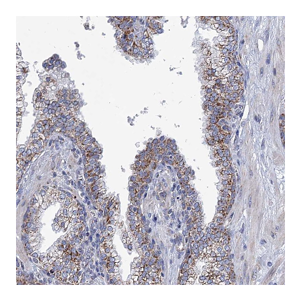 Atlas Antibodies Anti-NDUFC2 Antibody