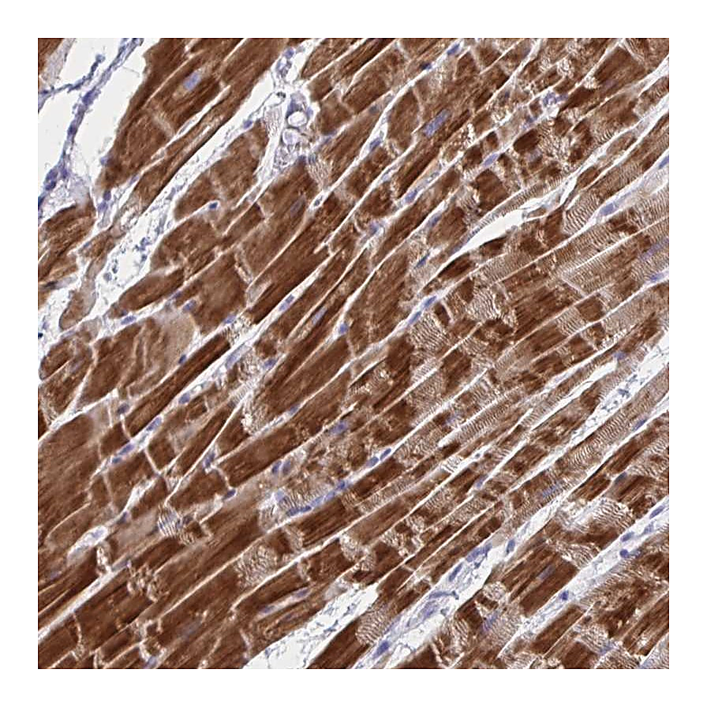 Atlas Antibodies Anti-NDUFC2 Antibody