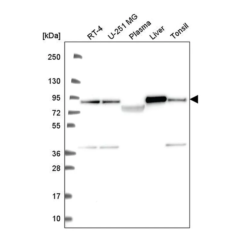 Atlas Antibodies Anti-NDUFS1 Antibody