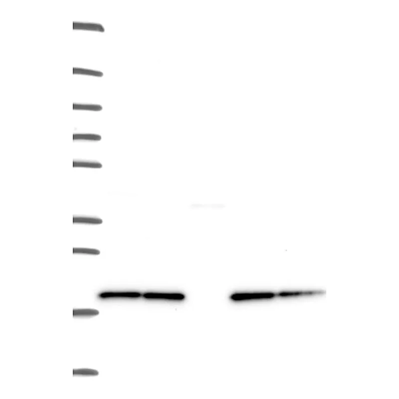 Atlas Antibodies Anti-NDUFB8 Antibody