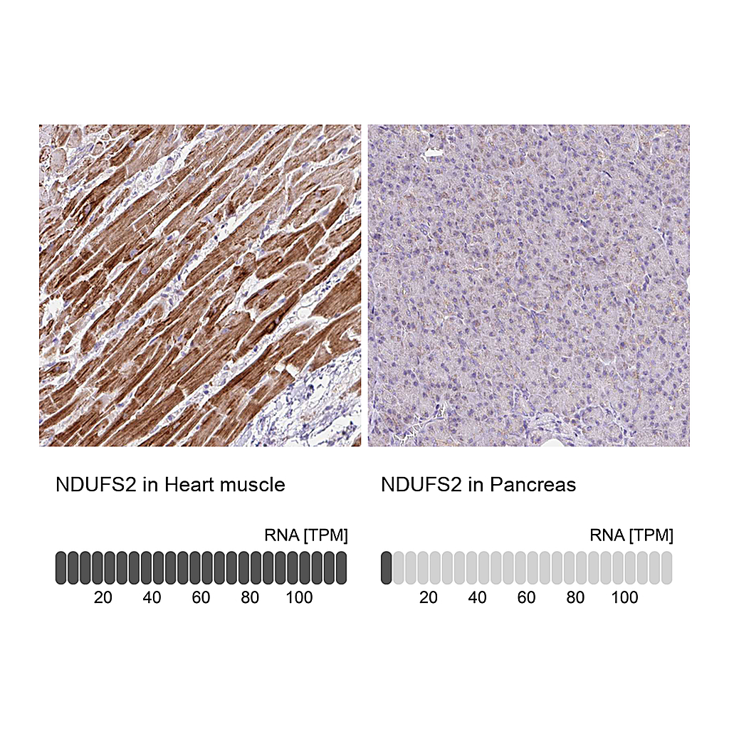 Atlas Antibodies Anti-NDUFS2 Antibody