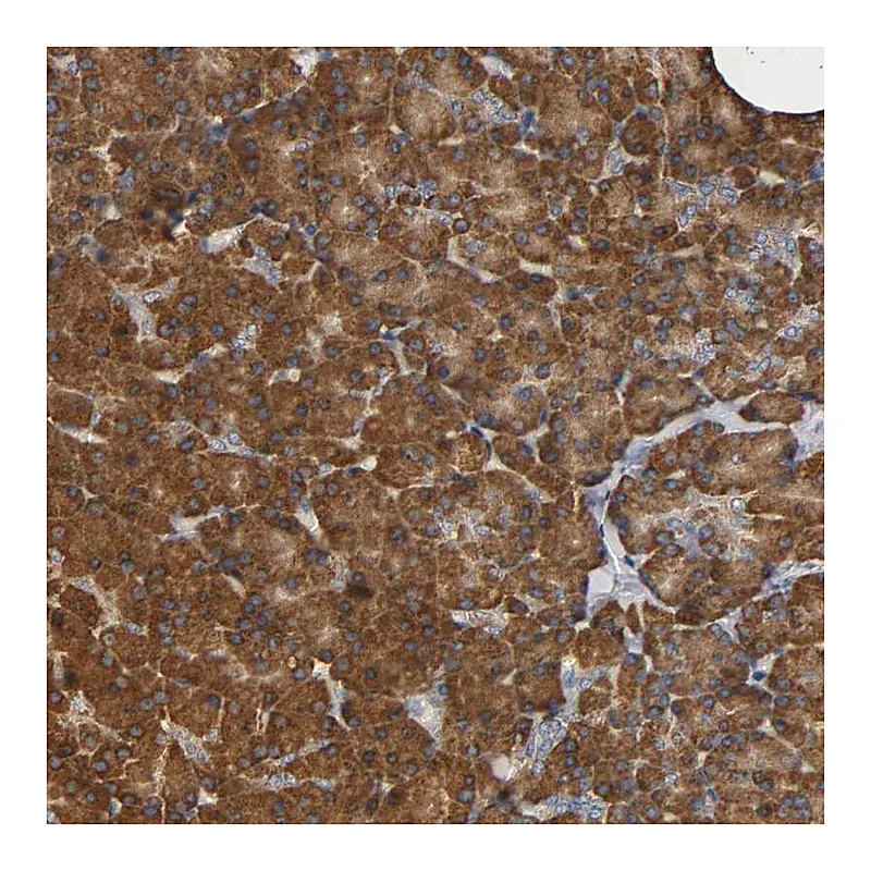 Atlas Antibodies Anti-NDUFS3 Antibody