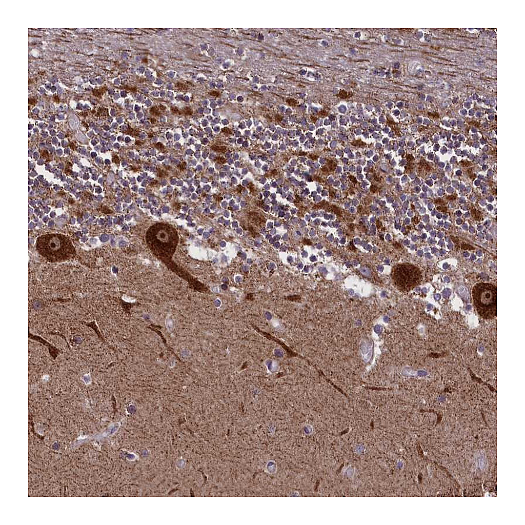 Atlas Antibodies Anti-NDUFS5 Antibody