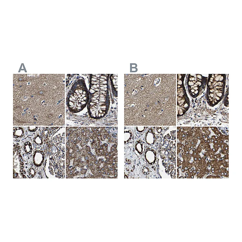 Atlas Antibodies Anti-NDUFV3 Antibody