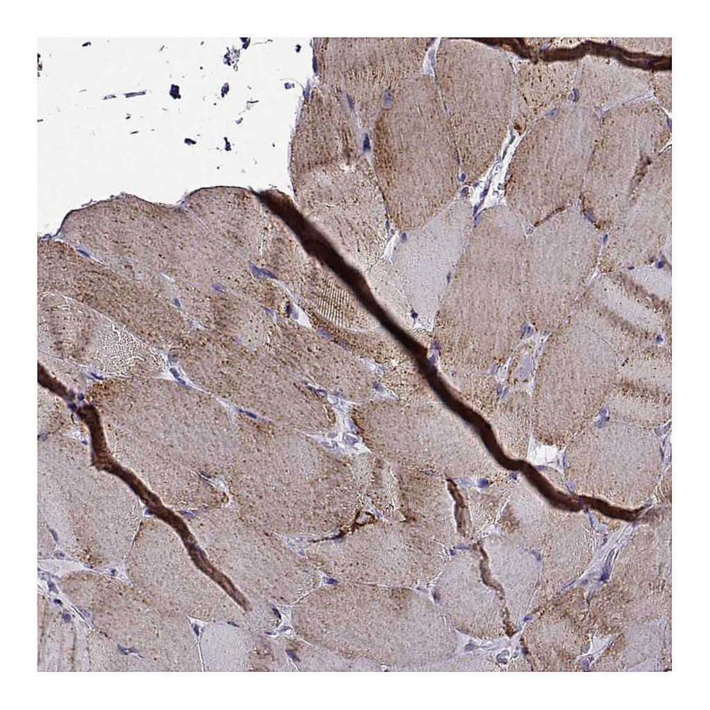 Atlas Antibodies Anti-NECAB3 Antibody
