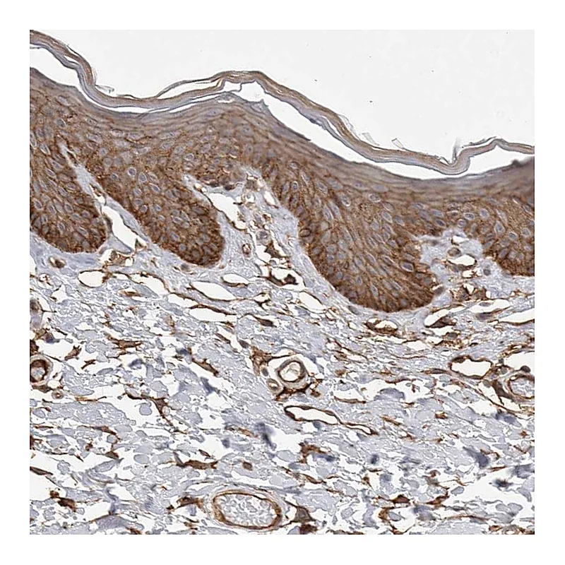 Atlas Antibodies Anti-NECTIN1 Antibody