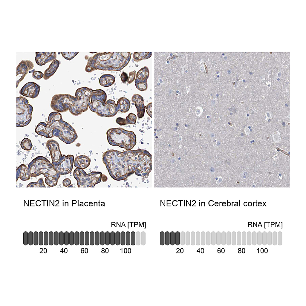 Atlas Antibodies Anti-NECTIN2 Antibody