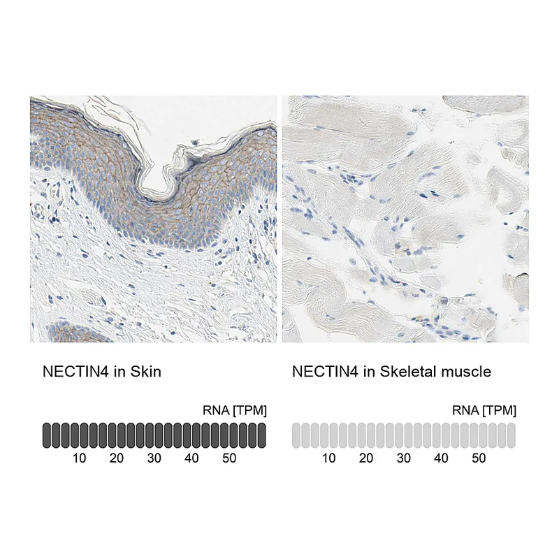 Atlas Antibodies Anti-NECTIN4 Antibody