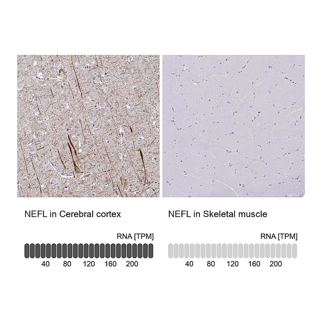 Atlas Antibodies Anti-NEFL Antibody