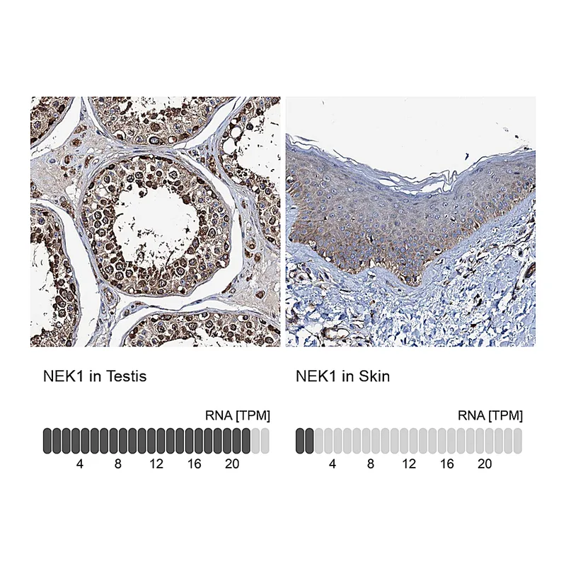 Atlas Antibodies Anti-NEK1 Antibody
