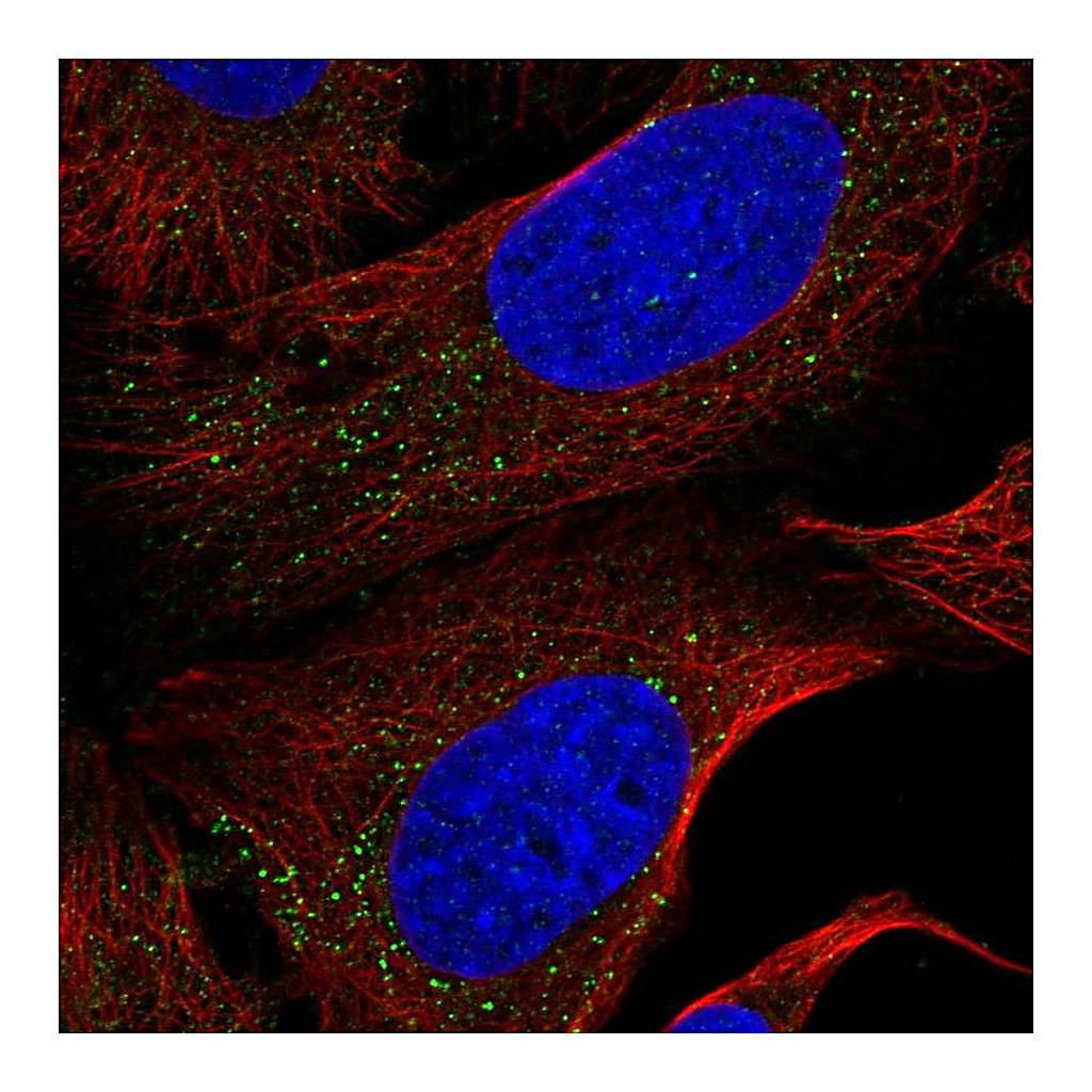 Atlas Antibodies Anti-NEK4 Antibody