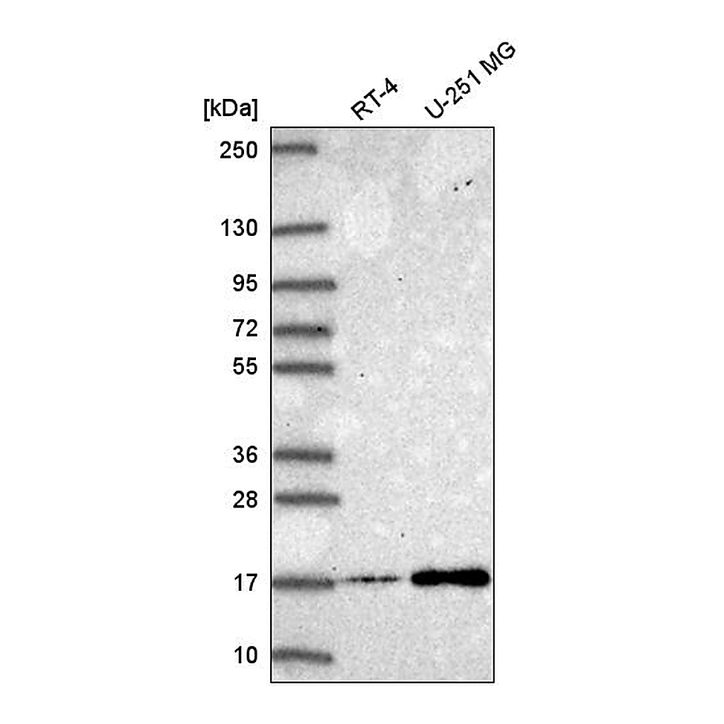 Atlas Antibodies Anti-NEK6 Antibody