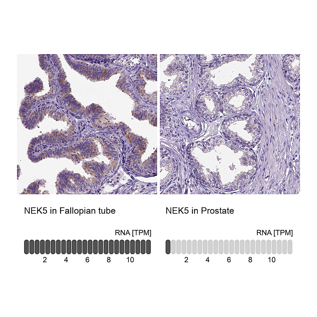 Atlas Antibodies Anti-NEK5 Antibody