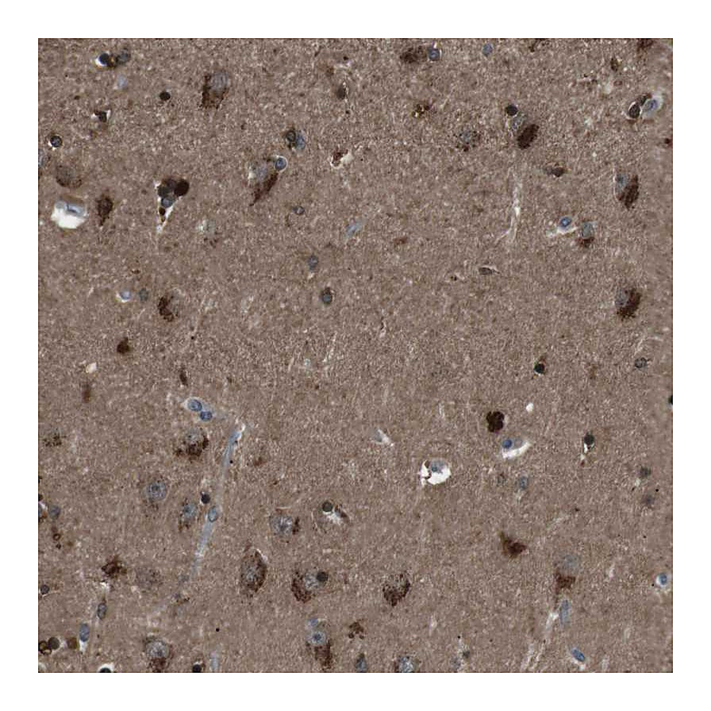 Atlas Antibodies Anti-NEK7 Antibody