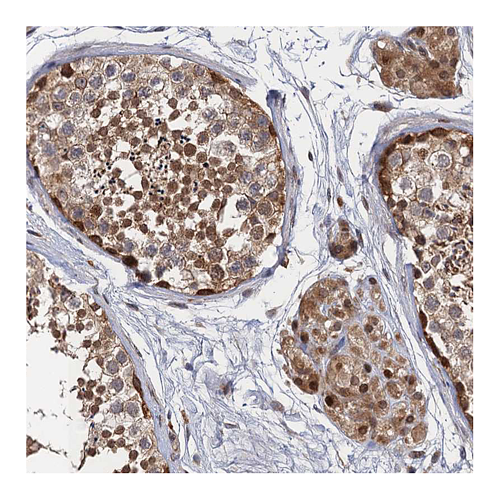 Atlas Antibodies Anti-NEK8 Antibody